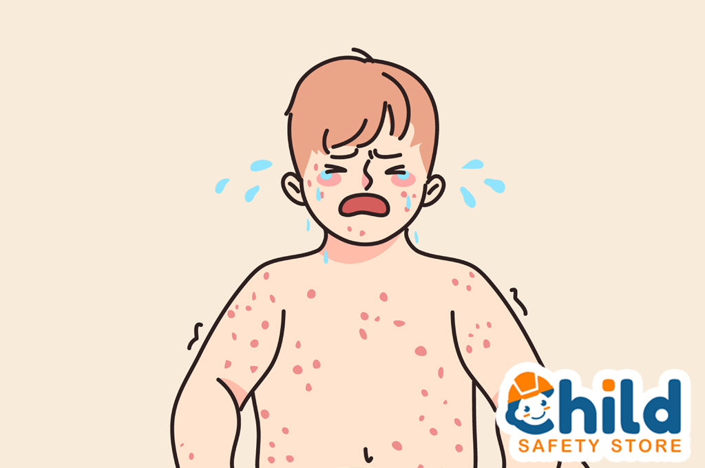 Avoiding Hot Tub Rash — Child Safety Store
